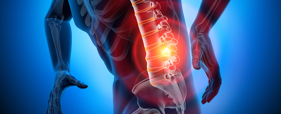 back-pain