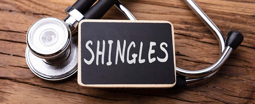 shingles
