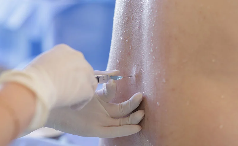 Epidural Steroid Injections at Republic Pain & Longevity in Bryan, TX