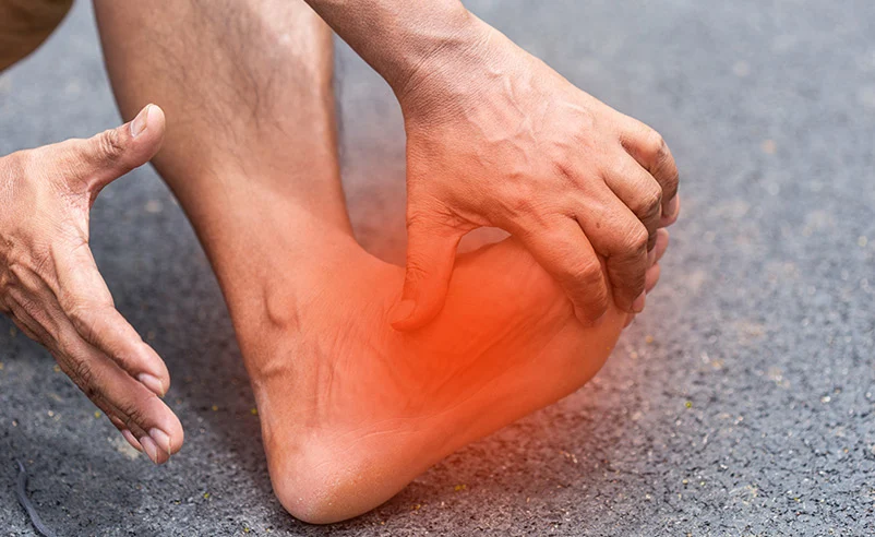 Plantar Fasciitis treatment in Bryan, TX